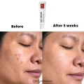 W.Skin Laboratory A.M Boosting Serum (Anti-Melasma ) – 30ml thumbnail 3