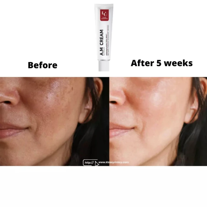 W.Skin Laboratory A.M Boosting Serum (Anti-Melasma ) – 30ml image 2