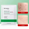 Bioaqua Salicylic Acid Acne Removal Facial Mask 25g - Anti-Acne & Pore Purifying | Shei Shop thumbnail 1