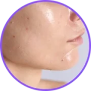Oily