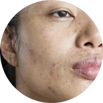 Dark Spot