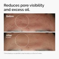 The Ordinary Niacinamide 10% + Zinc 1% | 100% Canada Imported thumbnail 2