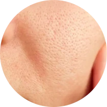 Pores Care