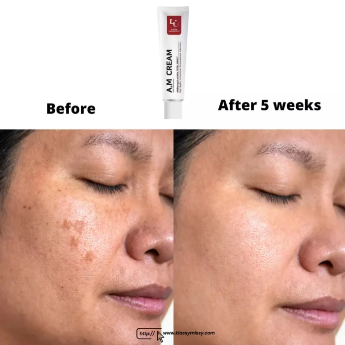 W.Skin Laboratory A.M Boosting Serum (Anti-Melasma ) – 30ml image 3