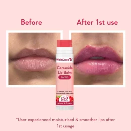 Wishcare Ceramide Tinted Lip Balm SPF50 5g | Shei Shop