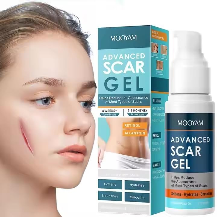 Advanced Scar Gel with Retinol & Allantoin - 8 Weeks Treatment