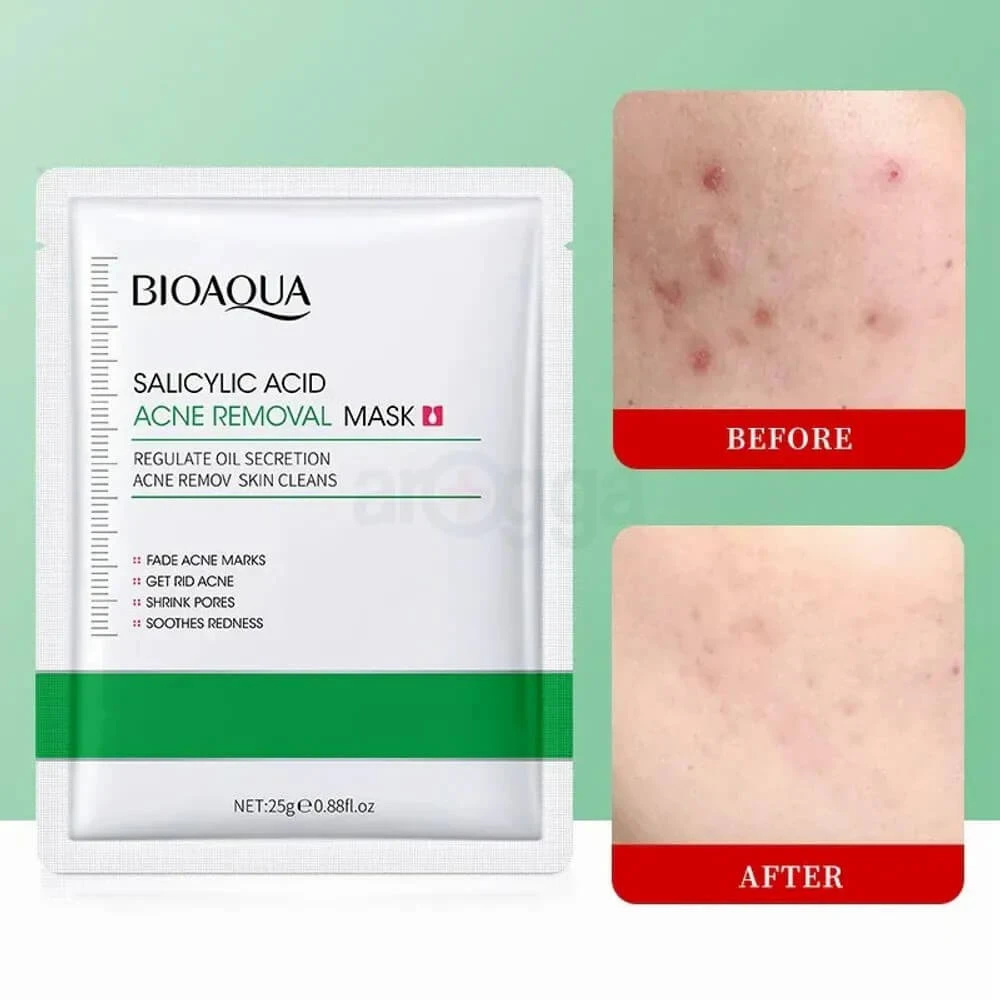 Bioaqua Salicylic Acid Acne Removal Facial Mask 25g - Anti-Acne & Pore Purifying | Shei Shop
