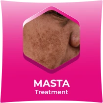 Masta Treatment