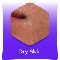 Dry