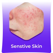 Senstive